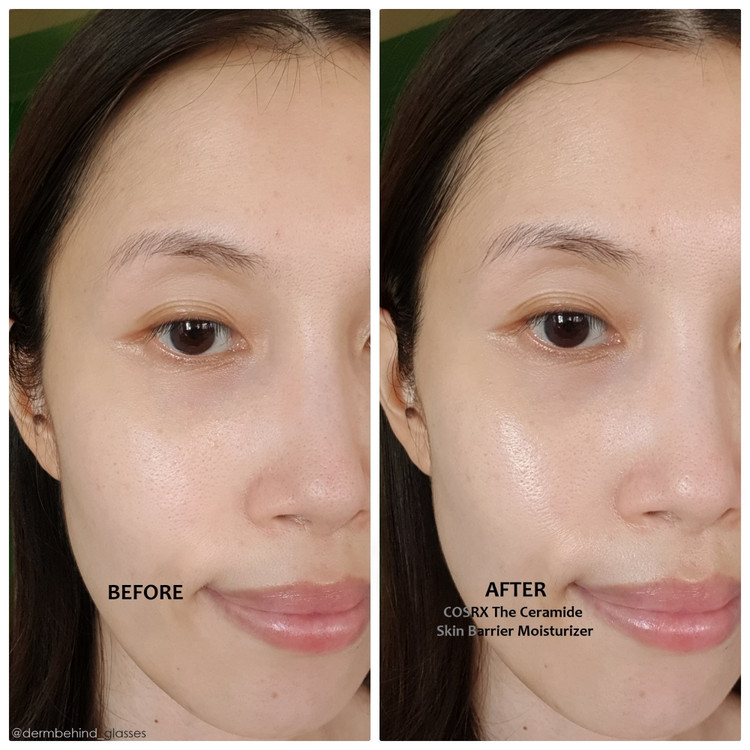 مرطوب کننده کوزارکس