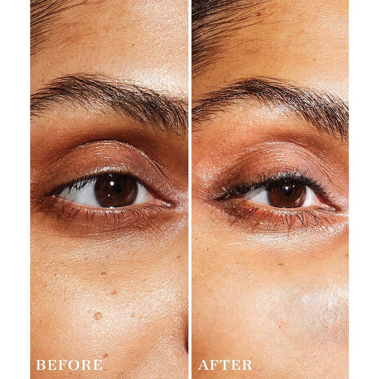 سرم دورچشم بالانس